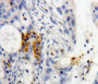 DAB staining on fromalin fixed paraffin-embedded pancreas tissue)