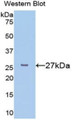 Western Blot; Sample: Recombinant protein.