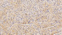 DAB staining on fromalin fixed paraffin-embedded Liver tissue)