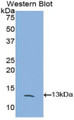 Western Blot; Sample: Recombinant protein.