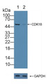 Knockout Varification: &lt;br/&gt;Lane 1: Wild-type HepG2 cell lysate; &lt;br/&gt;Lane 2: CDK18 knockout HepG2 cell lysate; &lt;br/&gt;Predicted MW: 54~58kd &lt;br/&gt;Observed MW: 50kd&lt;br/&gt;Primary Ab: 1µg/ml Rabbit Anti-Human CDK18 Antibody&lt;br/&gt;Second Ab: 0.2µg/mL HRP-Linked Caprine Anti-Rabbit IgG Polyclonal Antibody&lt;br/&gt;