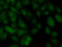 FITC staining on IF; Samples: Human Hela Cells;  Primary Ab: 20µg/ml Rabbit Anti-Human UBE2C Antibod