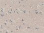 DAB staining on IHC-P; Samples: Human Cerebrum Tissue; Primary Ab: 30µg/ml Rabbit Anti-Human UBA52 Antibody Second Ab: 2µg/mL HRP-Linked Caprine Anti-Rabbit IgG Polyclonal Antibody