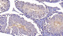DAB staining on IHC-P; Samples: Mouse Testis Tissue; Primary Ab: 30ug/ml Rabbit Anti-Mouse Bcl2L Antibody Second Ab: 2µg/mL HRP-Linked Caprine Anti-Rabbit IgG Polyclonal Antibody
