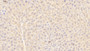 DAB staining on IHC-P; Samples: Mouse Liver Tissue;  Primary Ab: 20μg/ml Rabbit Anti-Mouse a1BG Antibody Second Ab: 2µg/mL HRP-Linked Caprine Anti-Rabbit IgG Polyclonal Antibody 