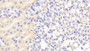 DAB staining on fromalin fixed paraffin-embedded Liver tissue)