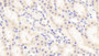 DAB staining on fromalin fixed paraffin- embedded Kidney tissue)