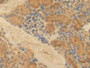 DAB staining on fromalin fixed paraffin-embedded Kidney tissue)
