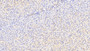 DAB staining on IHC-P; Samples: Human Liver Tissue;  Primary Ab: 20μg/ml Rabbit Anti-Human MFRN Antibody Second Ab: 2µg/mL HRP-Linked Caprine Anti-Rabbit IgG Polyclonal Antibody 