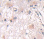 Taurine Transporter (Taut) Polyclonal Antibody, Cat#CAU22831