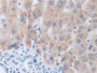 DAB staining on IHC-P; Samples: Human Liver Tissue.