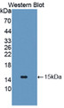 Western Blot; Sample: Recombinant protein.