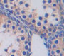 Glucose Transporter 14 (Glut14) Polyclonal Antibody, Cat#CAU22840