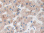 DAB staining on IHC-P; Samples: Human Liver Tissue; Primary Ab: 10µg/ml Rabbit Anti-Human RHOQ Antibody Second Ab: 2µg/mL HRP-Linked Caprine Anti-Rabbit IgG Polyclonal Antibody