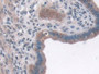 DAB staining on IHC-P; Samples: Mouse Uterus Tissue; Primary Ab: 10µg/ml Rabbit Anti-Mouse IQGAP1 Antibody Second Ab: 2µg/mL HRP-Linked Caprine Anti-Rabbit IgG Polyclonal Antibody