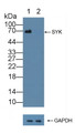Knockout Varification: ; Lane 1: Wild-type 293T cell lysate; ; Lane 2: SYK knockout 293T cell lysate; ; Predicted MW: 69,72kd ; Observed MW: 69kd; Primary Ab: 5µg/ml Rabbit Anti-Human SYK Antibody; Second Ab: 0.2µg/mL HRP-Linked Caprine Anti-Rabbit IgG Polyclonal Antibody;