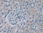 DAB staining on IHC-P; Samples: Rat Kidney Tissue; Primary Ab: 20µg/ml Rabbit Anti-Rat ROS1 Antibody Second Ab: 2µg/mL HRP-Linked Caprine Anti-Rabbit IgG Polyclonal Antibody