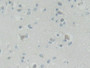DAB staining on IHC-P; Samples: Human Cerebrum Tissue; Primary Ab: 30µg/ml Rabbit Anti-Human ROR2 Antibody Second Ab: 2µg/mL HRP-Linked Caprine Anti-Rabbit IgG Polyclonal Antibody