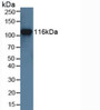 Western Blot; Sample: Human Jurkat Cells.