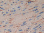 DAB staining on IHC-P; Samples: Mouse Heart Tissue; Primary Ab: 10µg/ml Rabbit Anti-Mouse MUSK Antibody Second Ab: 2µg/mL HRP-Linked Caprine Anti-Rabbit IgG Polyclonal Antibody