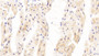 DAB staining on IHC-P; Samples: Human Cardiac Muscle Tissue; Primary Ab: 20μg/ml Rabbit Anti-Human P4Ha3 Antibody Second Ab: 2µg/mL HRP-Linked Caprine Anti-Rabbit IgG Polyclonal Antibody