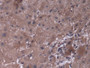 DAB staining on IHC-P; Samples: Human Liver Tissue)