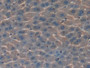 DAB staining on IHC-P; Samples: Mouse Liver Tissue