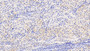 DAB staining on IHC-P. Samples: Human Tissue)