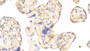 DAB staining on IHC-P; Samples: Human Placenta Tissue; Primary Ab: 20μg/ml Rabbit Anti-Human CDO1 Antibody Second Ab: 2µg/mL HRP-Linked Caprine Anti-Rabbit IgG Polyclonal Antibody