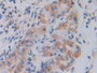 DAB staining on IHC-P; Samples: Human Stomach Tissue; Primary Ab: 20µg/ml Rabbit Anti-Human SHMT2 Antibody Second Ab: 2µg/mL HRP-Linked Caprine Anti-Rabbit IgG Polyclonal Antibody