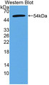 Western Blot; Sample: Recombinant protein.