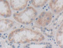 DAB staining on IHC-P; Samples: Human Kidney Tissue; Primary Ab: 30µg/ml Rabbit Anti-Human CTRB1 Antibody Second Ab: 2µg/mL HRP-Linked Caprine Anti-Rabbit IgG Polyclonal Antibody