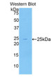 Western Blot; Sample: Recombinant protein.