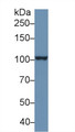 Western Blot; Sample: Human PANC1 cell lysate; Primary Ab: 1µg/ml Rabbit Anti-Human PSA Antibody Second Ab: 0.2µg/mL HRP-Linked Caprine Anti-Rabbit IgG Polyclonal Antibody