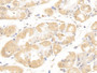 DAB staining on IHC-P. Samples: Human Tissue)