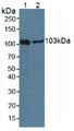 Western Blot; Sample: Lane1: Porcine Brain Tissue; Lane2: Human Lung Tissue.