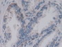 DAB staining on fromalin fixed paraffin-embedded Liver tissue)