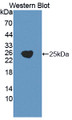 Western Blot; Sample: Recombinant protein.