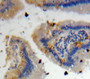 Used in DAB staining on fromalin fixed paraffin-embedded Intestine tissue