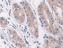 DAB staining on IHC-P; Samples: Human Stomach Tissue; Primary Ab: 10µg/ml Rabbit Anti-Human LDHD Antibody Second Ab: 2µg/mL HRP-Linked Caprine Anti-Rabbit IgG Polyclonal Antibody