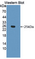 Western Blot; Sample: Recombinant protein.