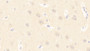 DAB staining on IHC-P; Samples: Human Cerebrum Tissue;  Primary Ab: 20μg/ml Rabbit Anti-Human PCDHb15 Antibody Second Ab: 2µg/mL HRP-Linked Caprine Anti-Rabbit IgG Polyclonal Antibody 