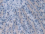 DAB staining on IHC-P; Samples: Rat Stomach Tissue; Primary Ab: 10µg/ml Rabbit Anti-Rat PPP2R4 Antibody Second Ab: 2µg/mL HRP-Linked Caprine Anti-Rabbit IgG Polyclonal Antibody