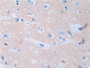 DAB staining on IHC-P; Samples: Human Cerebrum Tissue;  Primary Ab: 10µg/ml Rabbit Anti-Human PPP3R1