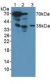 Western Blot; Sample: Lane1: Rat Serum; Lane2: Rat Heart Tissue; Lane3: Human MCF7 Cells.