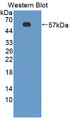 Western Blot; Sample: Recombinant protein.