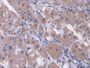 DAB staining on IHC-P; Samples: Human Stomach Tissue; Primary Ab: 20µg/ml Rabbit Anti-Human RARb Antibody Second Ab: 2µg/mL HRP-Linked Caprine Anti-Rabbit IgG Polyclonal Antibody