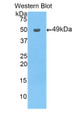 Western Blot; Sample: Recombinant protein.