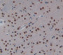 Pregnane X Receptor (Pxr) Polyclonal Antibody, Cat#CAU22964