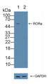 Knockout Varification: ; Lane 1: Wild-type PC3 cell lysate; ; Lane 2: RORa knockout PC3 cell lysate; ; Predicted MW: 63kd ; Observed MW: 54kd; Primary Ab: 1µg/ml Rabbit Anti-Human RORa Antibody; Second Ab: 0.2µg/mL HRP-Linked Caprine Anti-Rabbit IgG Polyclonal Antibody;